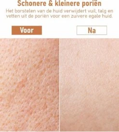 Fesio Lichaamsborstel Met Lange Steel - Dubbelzijdig - Dry Brushing Rugborstel/Badborstel/Doucheborstel/Huidborstel - 43 Cm -Lichaamsverzorging Winkel 1080x1200 1