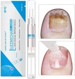 Anti- Kalknagel Behandeling Puur Natuur