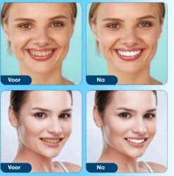 Diamond White - Teeth Whitening Strips - 28x Strips - Zonder Peroxide (0%) - Tandenbleekset - Tandenbleek Strips – Mint -Lichaamsverzorging Winkel 1185x1200 5