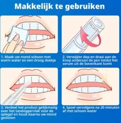 B-care Tanden Bleekpen - Teeth Whitening Pen - Tanden Bleker - Wittere Tanden - Teeth Whitening Strips - Professioneel Resultaat - Tandsteen Verwijderaar - Zonder Peroxide - Tandenbleekset - Tanden Bleken -Lichaamsverzorging Winkel 1185x1200 6