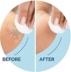 Scholl Velvet Smooth Voetvijl Wet & Dry - Starter - 1 Stuk -Lichaamsverzorging Winkel 1196x1200