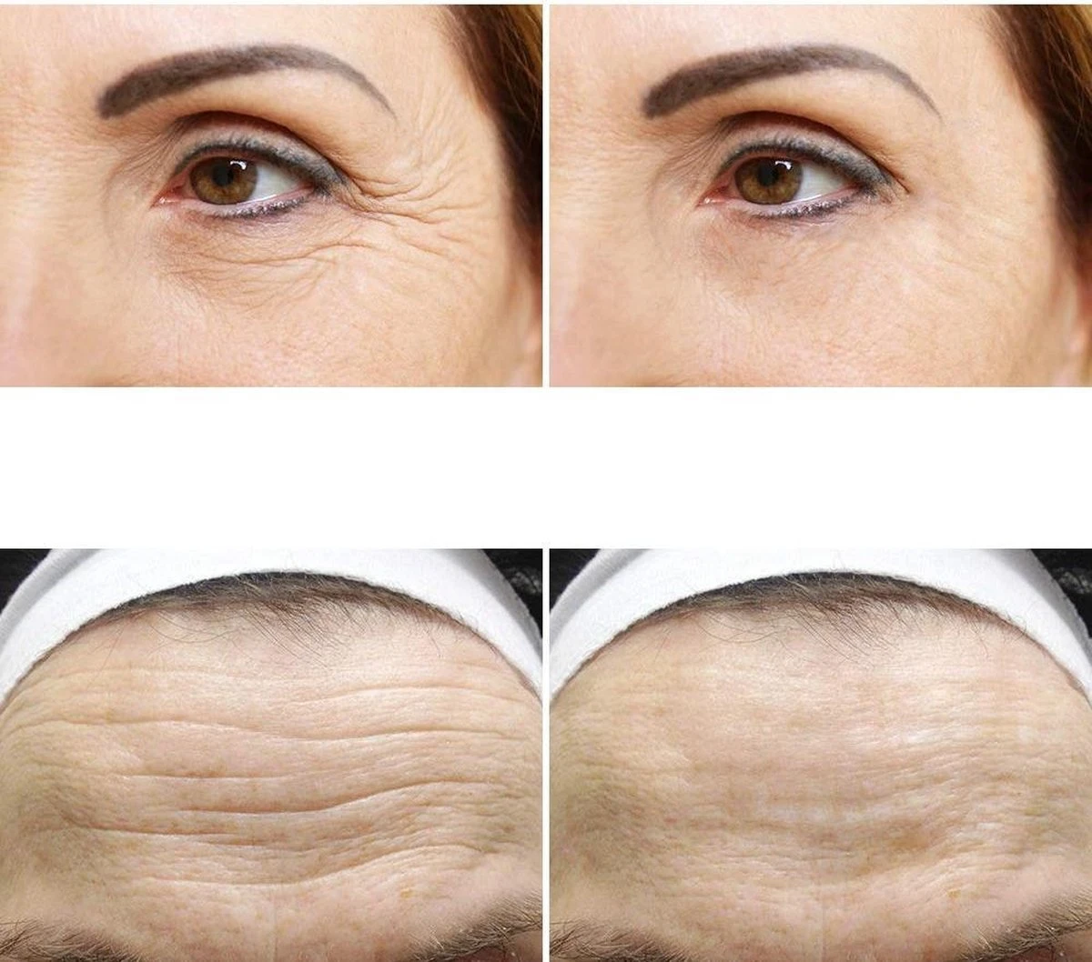 Simia™ Anti Rimpel Beauty Pads - Face Set (7 Stuks) - Voorhoofd Mond & Ogen - Herbruikbaar Anti Aging Siliconen Pad Tegen Lijntjes En Rimpels 4 Simia™ Anti Rimpel Beauty Pads - Face Set (7 Stuks) - Voorhoofd Mond & Ogen - Herbruikbaar Anti Aging Siliconen Pad Tegen Lijntjes En Rimpels - Afbeelding 2