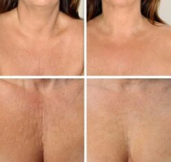 Simia™ Anti Rimpel Beauty Pads - Decolleté Large T Shape Set (2 Stuks) - Herbruikbaar Anti Aging Siliconen Pad Tegen Lijntjes En Slaaprimpels -Lichaamsverzorging Winkel 1200x1139 3