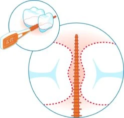 Tepe EasyPick Paars Maat XL – 36 Stuks -Lichaamsverzorging Winkel 1200x1146 6