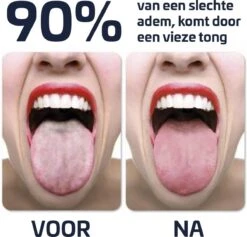 Effectieve Tongschraper - Tongreiniger - Rose Goud