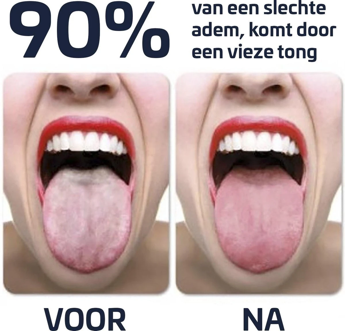 Effectieve Tongschraper - Tongreiniger - Rose Goud 3 Effectieve Tongschraper - Tongreiniger - Rose Goud