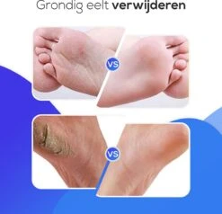 LifeWise Elektrische Eelt Verwijderaar - Voetvijl - 60 Vervangbare Schuurpads - Netstroom Adapter -Lichaamsverzorging Winkel 1200x1155 1