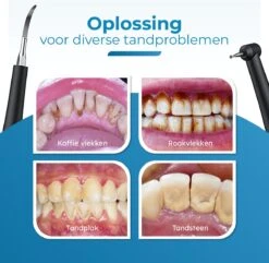 Professionele Tandsteen Verwijderaar - 5 Standen - Inclusief Tandarts Set - Met 3 Opzetstukken - Elektrisch - Tandplak -Lichaamsverzorging Winkel 1200x1169 4