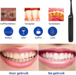 ExCorn Elektrische Tandsteen Verwijderaar - Inclusief 6-delig Tandartsset - 3 Standen - Elektrisch Tandplak Verwijderen - Tanden Polijsten -Lichaamsverzorging Winkel 1200x1173 6