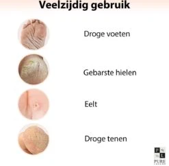 PureLuxure Voetmasker - Voetverzorging - Eeltsokken - Eelt Verwijderaar - Voetenmasker - Peel Off Masker - 1 Paar (2 Stuks) -Lichaamsverzorging Winkel 1200x1174