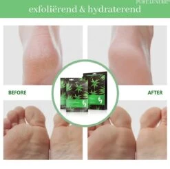 PureLuxure Voetmasker - Voetverzorging - Eeltsokken - Eelt Verwijderaar - Voetenmasker - Peel Off Masker - 1 Paar (2 Stuks) -Lichaamsverzorging Winkel 1200x1191 1