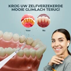Merkloos Tandsteen Verwijderaar Elektrisch – Tandenborstel Opzetstukken - Tandarts Spiegel - 5 Standen -Wit -Lichaamsverzorging Winkel 1200x1200 1235