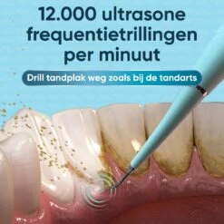 Whitee Elektrische Tandsteen Verwijderaar - Tanden Polijsten - Tandarts Tandsteenverwijderaars - Elektrisch Tandplak Verwijderen -Lichaamsverzorging Winkel 1200x1200 1254