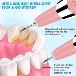 DEN-T® PRO U500 - Elektrische Sonische Tandsteen Verwijderaar - Roze 22 DEN-T® PRO U500 - Elektrische Sonische Tandsteen Verwijderaar - Roze -Lichaamsverzorging Winkel 1200x1200 1282