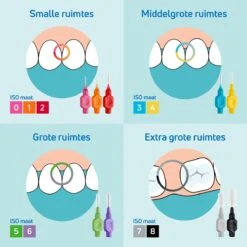 TePe Interdentale Ragers Original Geel ISO Maat 2 – 0,7 Mm (20 Stuks) -Lichaamsverzorging Winkel 1200x1200 1303