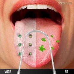 SolidStock Professionele Tongschraper Voor Mondverzorging - 4 Delige Tongreiniger - Ayurveda - RVS -Lichaamsverzorging Winkel 1200x1200 1347