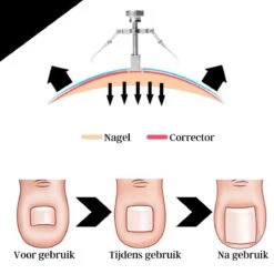 7-delige Pedicure En Manicure Set - Nagelknipper - Pedicureset - Nagelvijl - Nageltang - Kalknagel - Teennagelknipper -Lichaamsverzorging Winkel 1200x1200 326