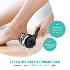 Vulpes BeautyCare® Elektrische Eelt Verwijderaar Pro – Stofzuigfunctie – 3 Snelheden – Inclusief 3 Vijlschijven & Borstel - USB-Oplaadbaar -Lichaamsverzorging Winkel 1200x1200 40