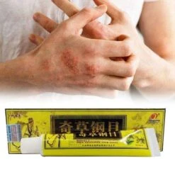 Psoriasis/exzeem Chineese Creme 17 Psoriasis/exzeem Chineese Creme -Lichaamsverzorging Winkel 1200x1200 432
