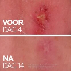 La Roche-Posay Cicaplast Balsem B5+ - 100ml - Voor Gevoelige Huid -Lichaamsverzorging Winkel 1200x1200 456