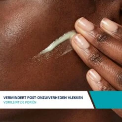 CeraVe Resurfacing Retinol Serum - 30ml - Voor Onzuivere Huid Met Neiging Tot Acne 17 CeraVe Resurfacing Retinol Serum - 30ml - Voor Onzuivere Huid Met Neiging Tot Acne -Lichaamsverzorging Winkel 1200x1200 459