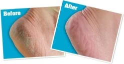 O'Keeffe's - Voetencreme - Voor Gezonde Voeten - Potje 96 Gram -Lichaamsverzorging Winkel 1200x622