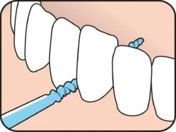 Tepe EasyPick Blauw Maat M/L – 36 Stuks -Lichaamsverzorging Winkel 1200x900 38