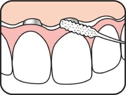Tepe Floss Bridge & Implant 30 St -Lichaamsverzorging Winkel 1200x901 1
