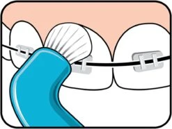 TePe Compact Tuft - Single Tufted Borstel - Tandenborstel -Lichaamsverzorging Winkel 1200x902 2