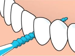 Tepe EasyPick Paars Maat XL – 36 Stuks -Lichaamsverzorging Winkel 1200x902 5