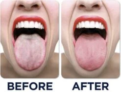 JuliBrite Tong Gel (50 ML) Tongreinigende Gel - Verfrist De Adem - Schone Tong -Lichaamsverzorging Winkel 1200x914