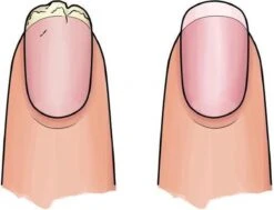 Herome 3 In 1 Manicure Nagelverzorging Set Blauw – Nagelset Voor Beschadigde Nagels - Nagelverharder, Nagellakremover En Nagelriemcreme - Set Van 3 -Lichaamsverzorging Winkel 1200x920