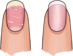 Herome 3 In 1 Manicure Nagelverzorging Set – Beschadigde Nagels – Nagelriemolie, Nagelriemcrème En Nagelverharder -Lichaamsverzorging Winkel 1200x925