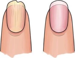 Herome 3 In 1 Manicure Nagelverzorging Set (Nail Essentials Geel) – Nagelset Voor Droge En Geribbelde Nagels – Base Coat, Vijl En Voedende Nagelolie – Voor Egale En Flexibele Nagels -Lichaamsverzorging Winkel 1200x926