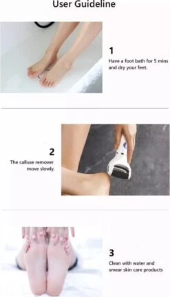 Vastu Eeltverwijderaar - Elektrische Oplaadbare Voetvijl Inclusief Opvangdoekje & Opbergzakje - Callus Remover - Inclusief Extra Opzetvijlen -Lichaamsverzorging Winkel 686x1200