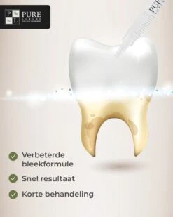 3x Navulling Tanden Bleekgel Spuiten ZONDER Peroxide - Refill Gel - Navulling - Veilig Tanden Bleken - Witte Tanden - Teeth Whitening - Valentijnsdag Cadeau -Lichaamsverzorging Winkel 960x1200 32